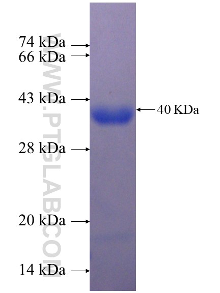 ZNF184 fusion protein Ag23322 SDS-PAGE