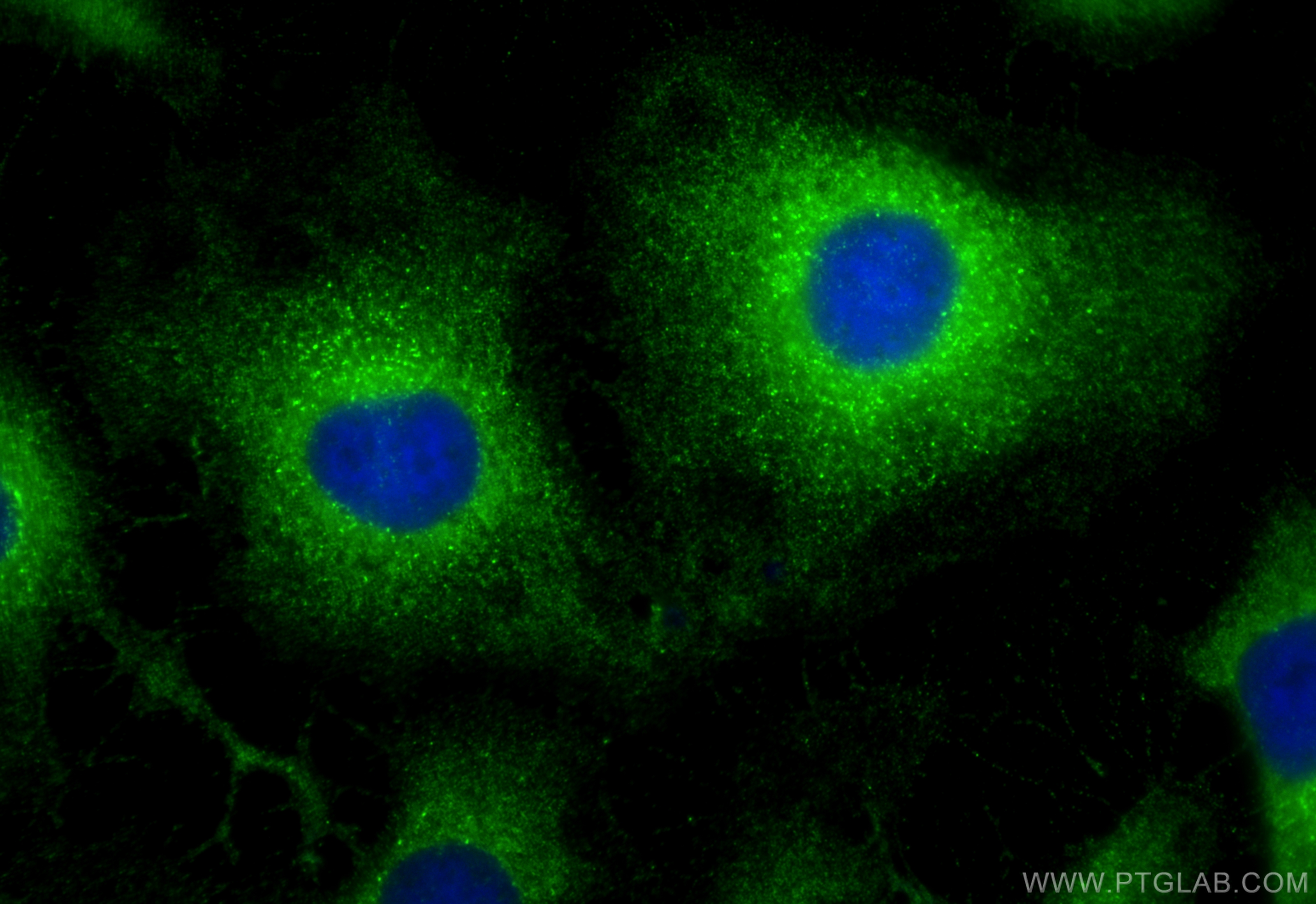 IF Staining of HeLa using 31477-1-AP IF Staining of HeLa using 31477-1-AP