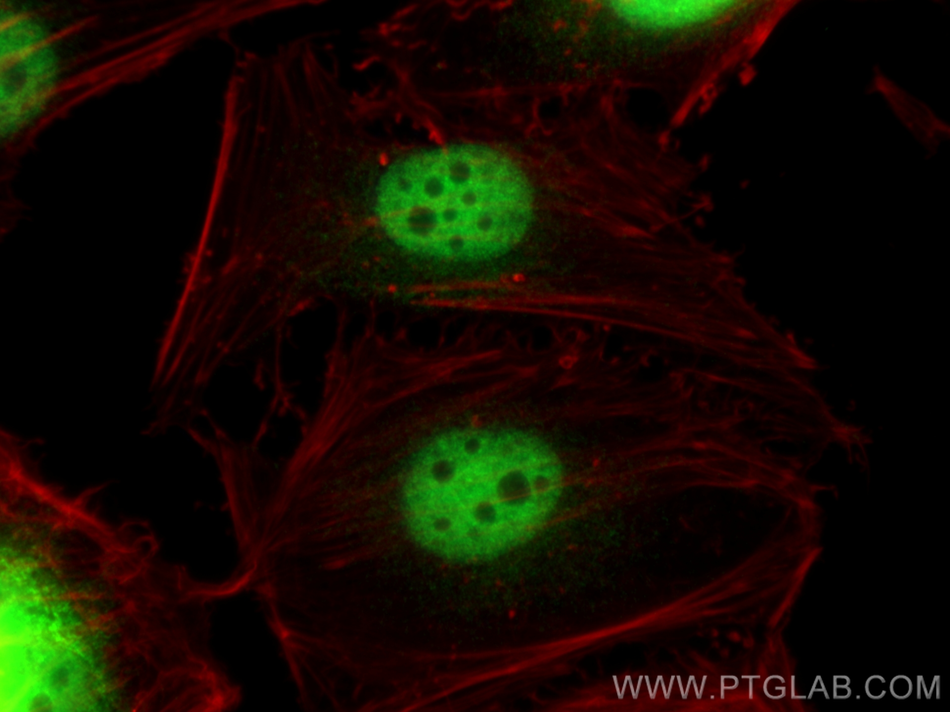 IF Staining of HeLa using 26169-1-AP