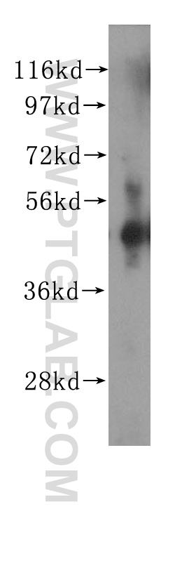 WB analysis of human spleen using 11282-1-AP