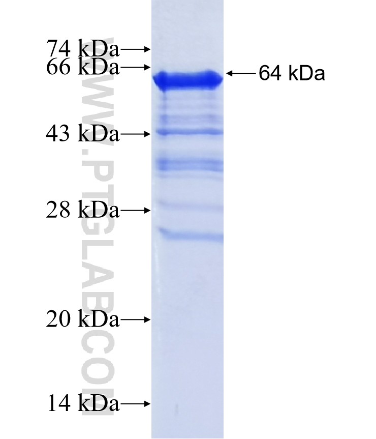 ZNF207 fusion protein Ag40360 SDS-PAGE ZNF207 fusion protein Ag40360 SDS-PAGE