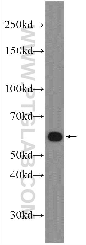 WB analysis of HeLa using 25458-1-AP (same clone as 25458-1-PBS)