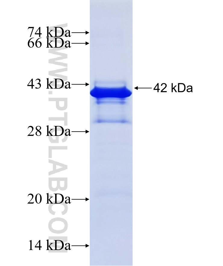 ZNF213 fusion protein Ag15636 SDS-PAGE ZNF213 fusion protein Ag15636 SDS-PAGE