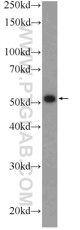 WB analysis of mouse brain using 25502-1-AP