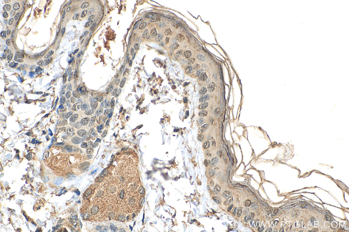 IHC staining of mouse skin using 67730-1-Ig (same clone as 67730-1-PBS)