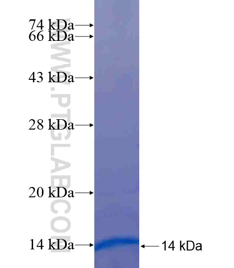 ZNF221 fusion protein Ag19692 SDS-PAGE ZNF221 fusion protein Ag19692 SDS-PAGE