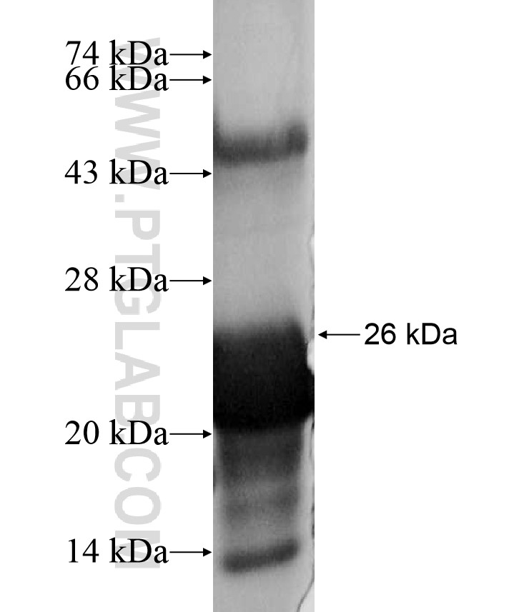 ZNF225 fusion protein Ag17217 SDS-PAGE ZNF225 fusion protein Ag17217 SDS-PAGE
