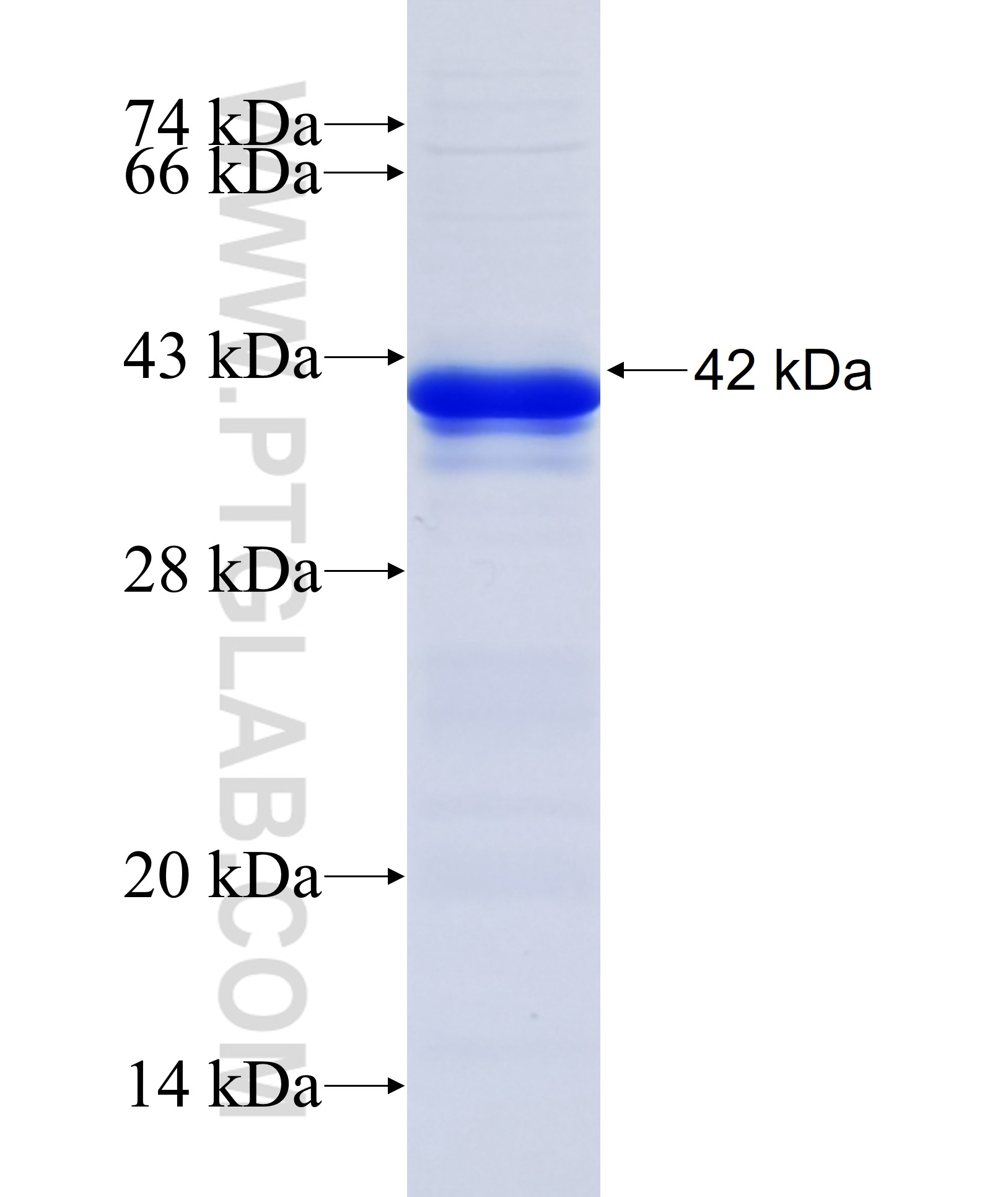 ZNF238 fusion protein Ag33690 SDS-PAGE ZNF238 fusion protein Ag33690 SDS-PAGE