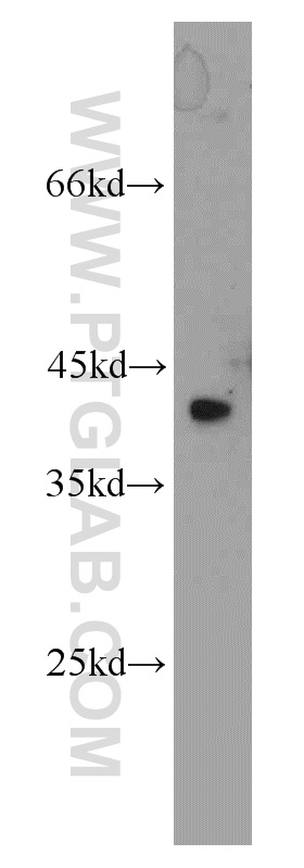 WB analysis of HeLa using 11219-1-AP