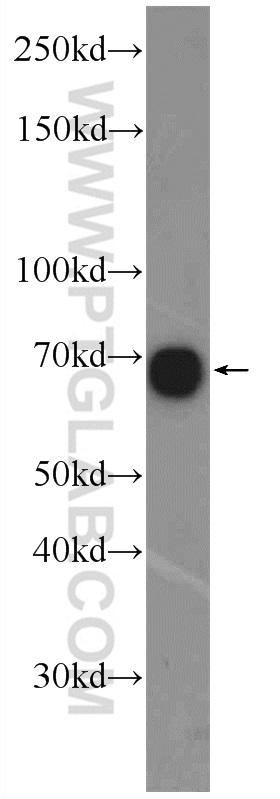 ZNF251