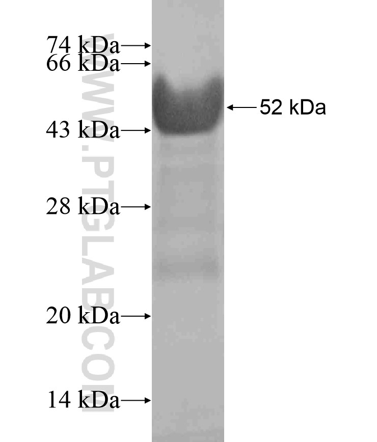 ZNF264 fusion protein Ag18205 SDS-PAGE ZNF264 fusion protein Ag18205 SDS-PAGE