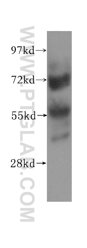 WB analysis of HeLa using 11374-1-AP