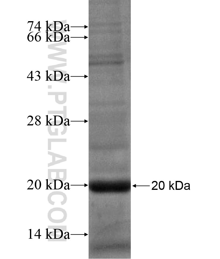 ZNF268 fusion protein Ag17375 SDS-PAGE ZNF268 fusion protein Ag17375 SDS-PAGE