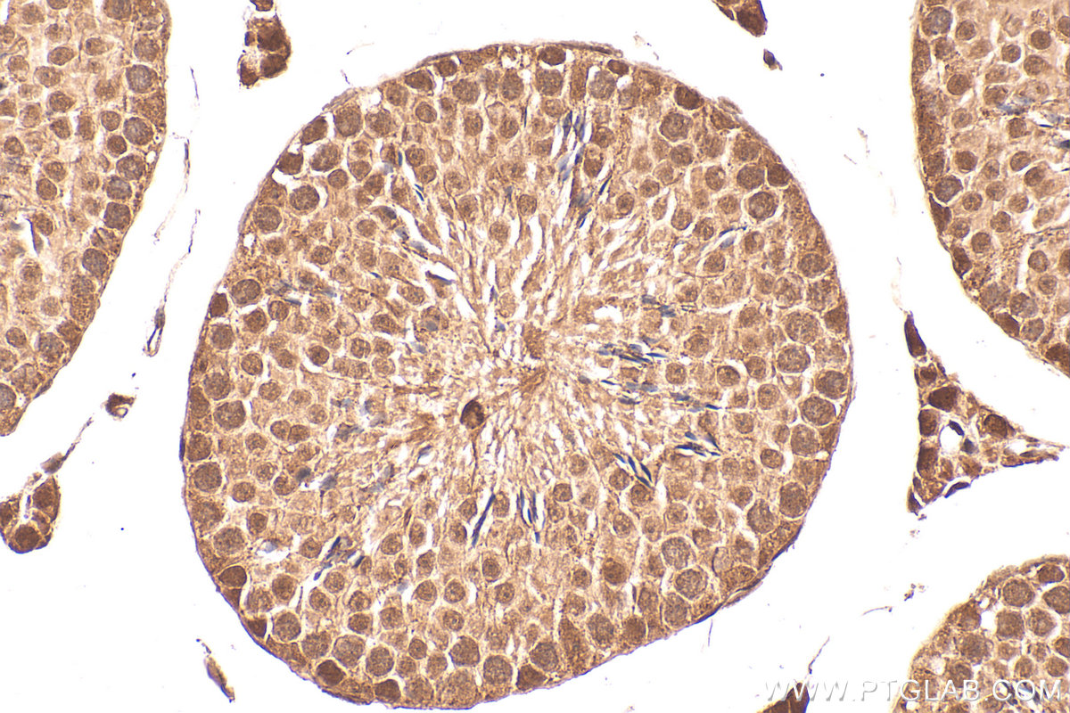 IHC staining of mouse testis using 25094-1-AP IHC staining of mouse testis using 25094-1-AP