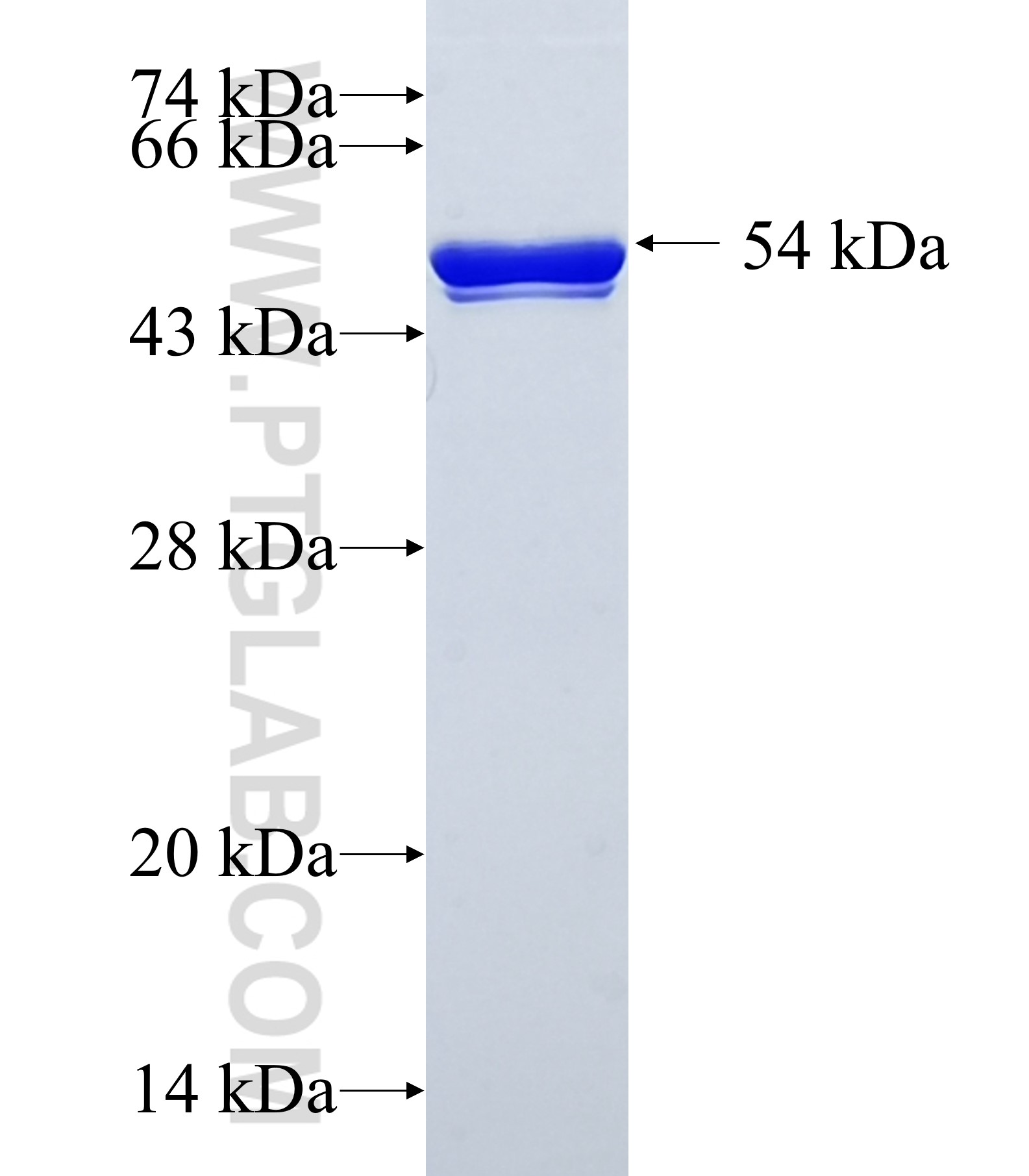 ZNF292 fusion protein Ag29336 SDS-PAGE ZNF292 fusion protein Ag29336 SDS-PAGE