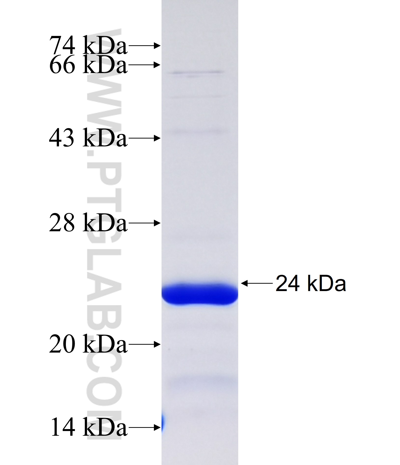ZNF296 fusion protein Ag38029 SDS-PAGE ZNF296 fusion protein Ag38029 SDS-PAGE