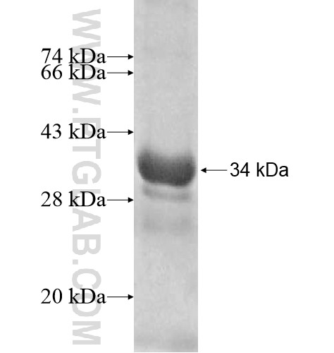 ZNF3 fusion protein Ag10662 SDS-PAGE ZNF3 fusion protein Ag10662 SDS-PAGE
