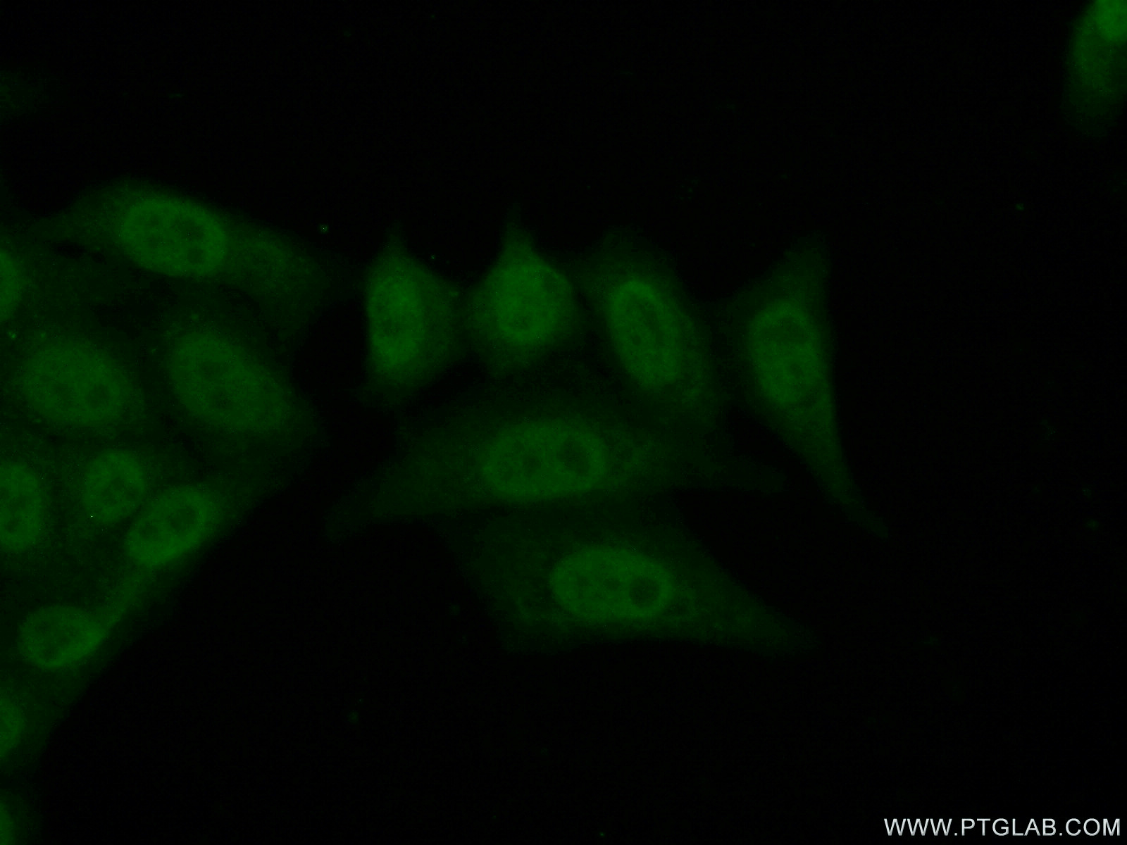 IF Staining of HepG2 using 24952-1-AP