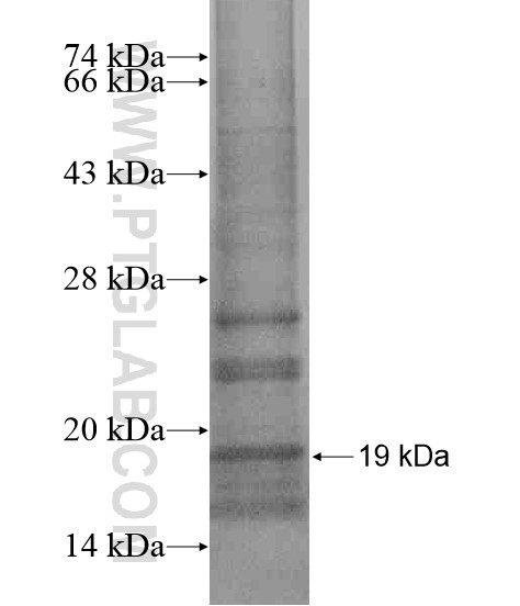 ZNF30 fusion protein Ag20281 SDS-PAGE ZNF30 fusion protein Ag20281 SDS-PAGE