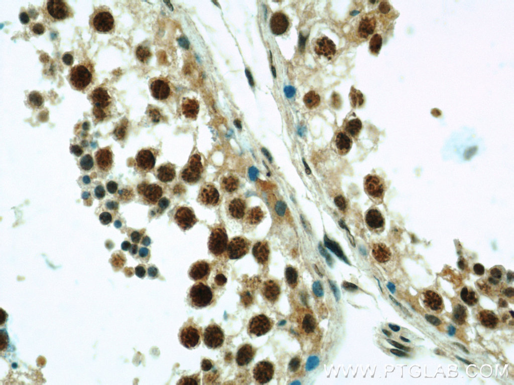 IHC staining of human testis using 23243-1-AP