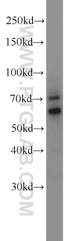 WB analysis of HL-60 using 23243-1-AP