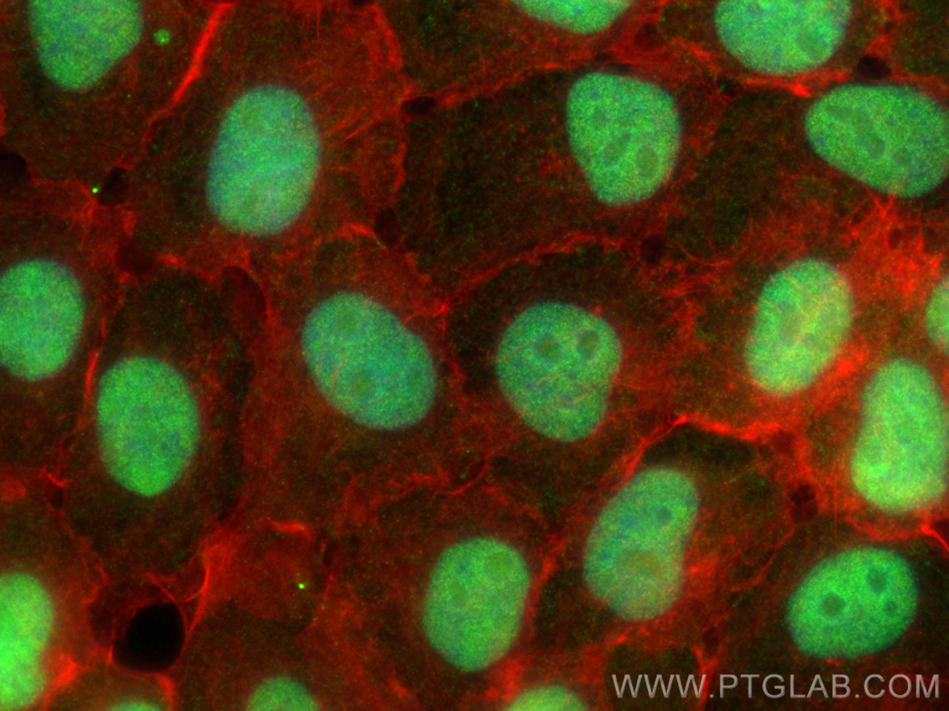 IF Staining of A431 using 26035-1-AP IF Staining of A431 using 26035-1-AP