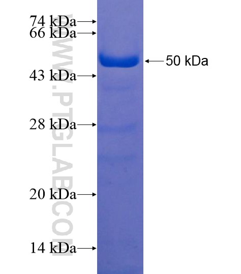 ZNF318 fusion protein Ag22019 SDS-PAGE ZNF318 fusion protein Ag22019 SDS-PAGE