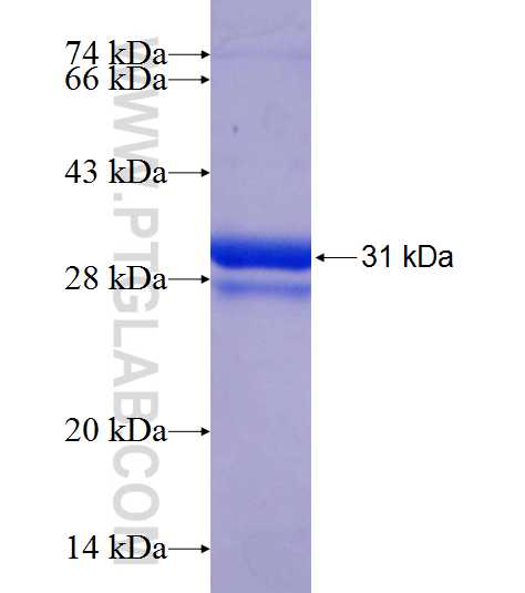 ZNF320 fusion protein Ag21730 SDS-PAGE ZNF320 fusion protein Ag21730 SDS-PAGE