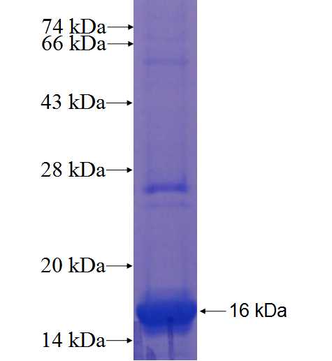 ZNF323 fusion protein Ag22372 SDS-PAGE ZNF323 fusion protein Ag22372 SDS-PAGE