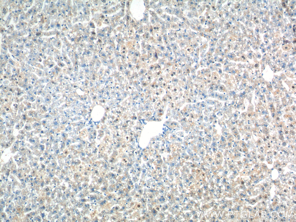 IHC staining of mouse liver using 25147-1-AP