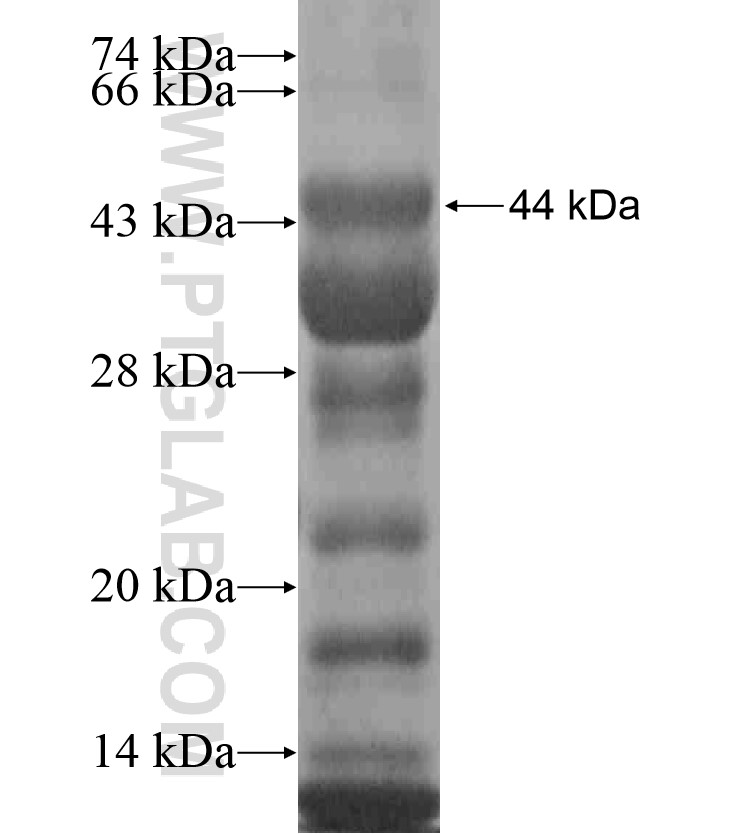 ZNF326 fusion protein Ag18422 SDS-PAGE ZNF326 fusion protein Ag18422 SDS-PAGE