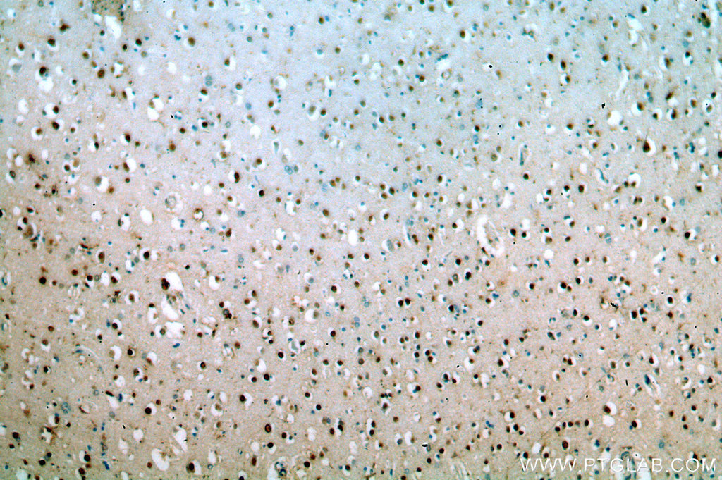 IHC staining of human brain using 20477-1-AP