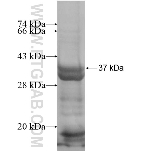 ZNF34 fusion protein Ag15011 SDS-PAGE ZNF34 fusion protein Ag15011 SDS-PAGE