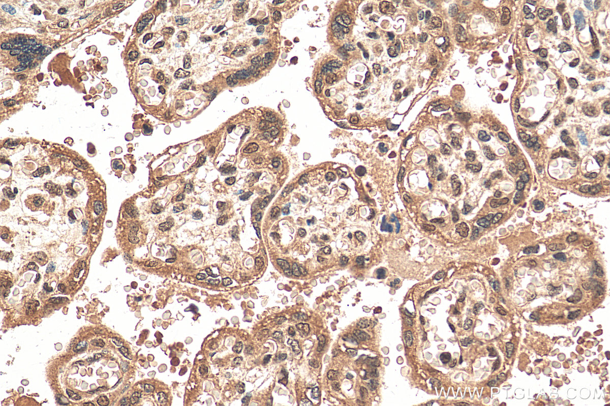 IHC staining of human placenta using 20794-1-AP