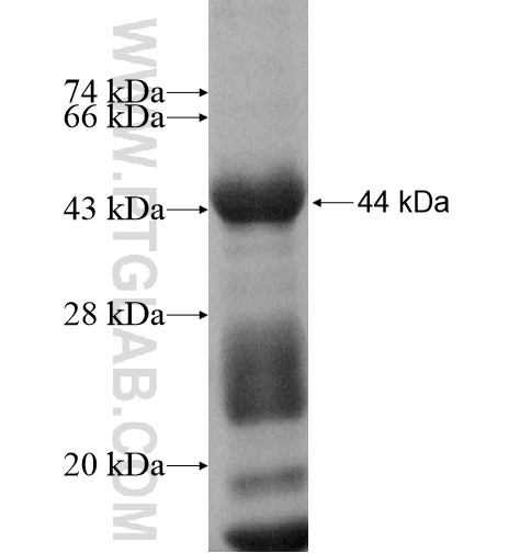 ZNF35 fusion protein Ag10457 SDS-PAGE ZNF35 fusion protein Ag10457 SDS-PAGE
