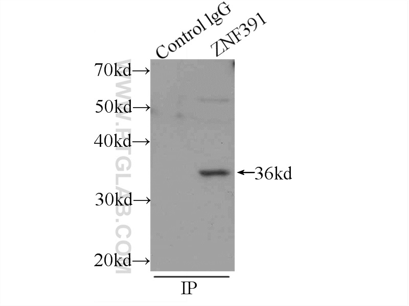 IP experiment of mouse testis using 24805-1-AP