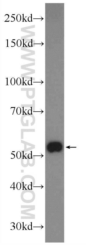 WB analysis of mouse brain using 25785-1-AP