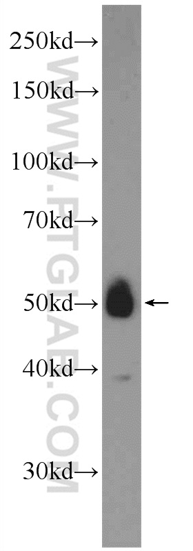 ZNF394