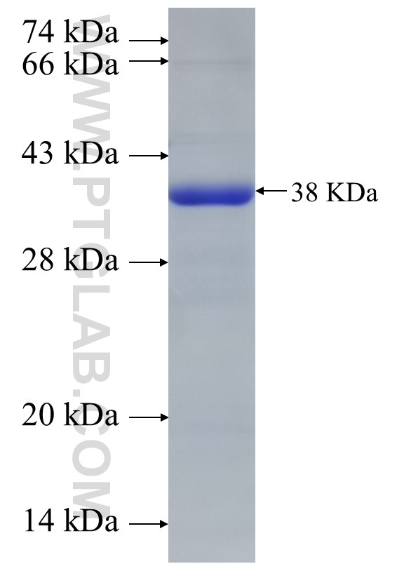 ZNF394 fusion protein Ag22656 SDS-PAGE ZNF394 fusion protein Ag22656 SDS-PAGE