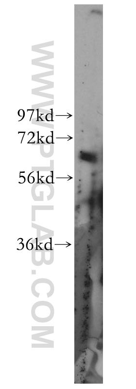 ZNF395