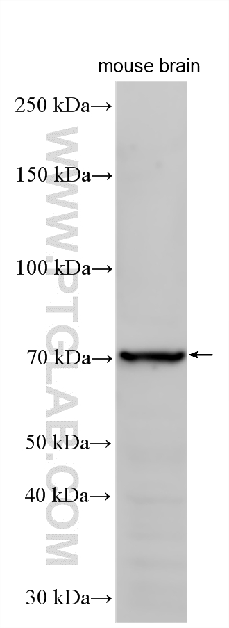 WB analysis using 21592-1-AP WB analysis using 21592-1-AP
