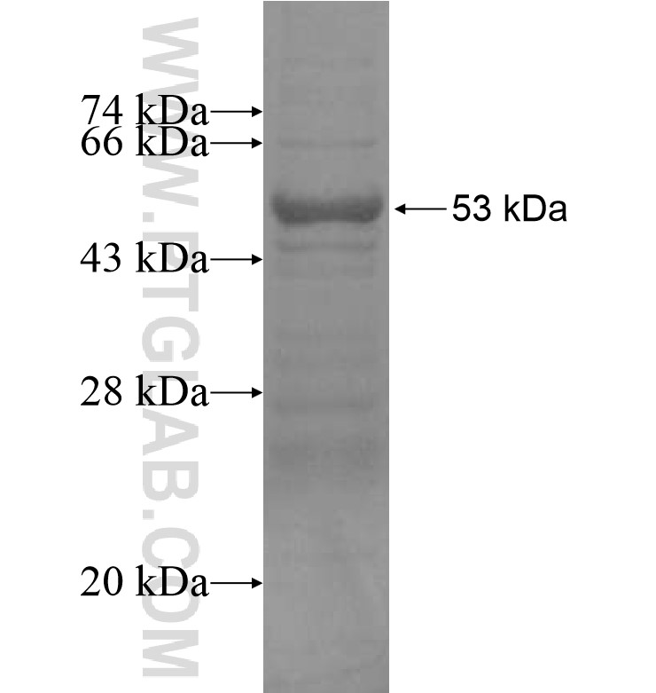 ZNF404 fusion protein Ag16166 SDS-PAGE ZNF404 fusion protein Ag16166 SDS-PAGE