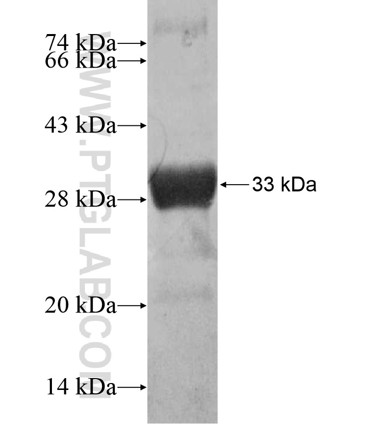 ZNF404 fusion protein Ag17033 SDS-PAGE ZNF404 fusion protein Ag17033 SDS-PAGE