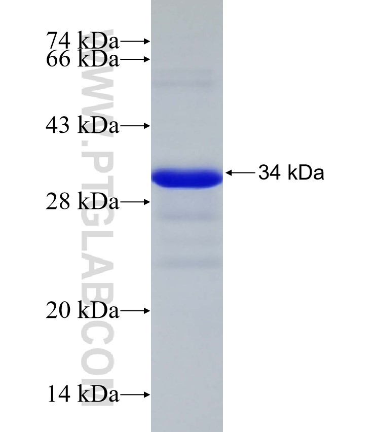 ZNF410 fusion protein Ag33017 SDS-PAGE ZNF410 fusion protein Ag33017 SDS-PAGE
