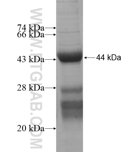 ZNF415 fusion protein Ag15604 SDS-PAGE ZNF415 fusion protein Ag15604 SDS-PAGE