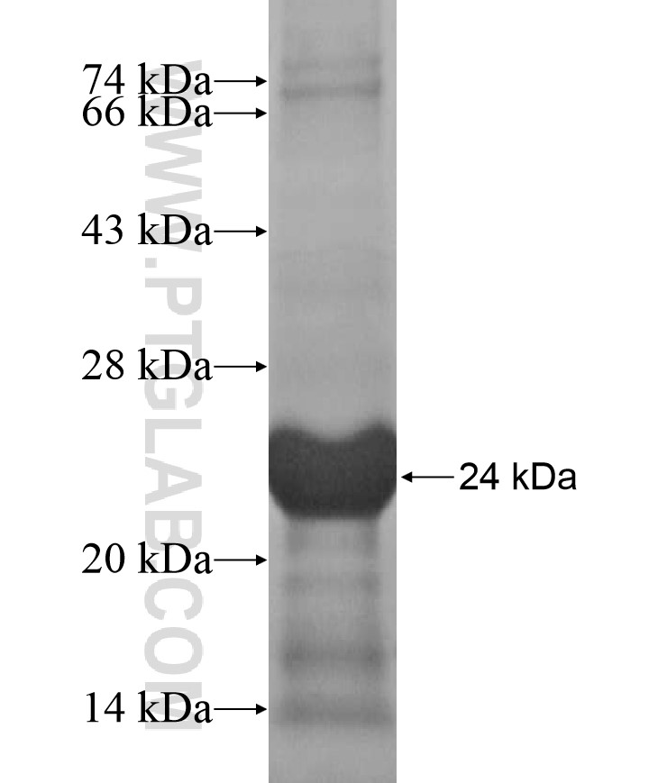 ZNF415 fusion protein Ag17146 SDS-PAGE ZNF415 fusion protein Ag17146 SDS-PAGE