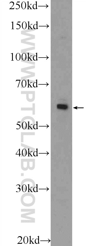 WB analysis of A549 using 25724-1-AP