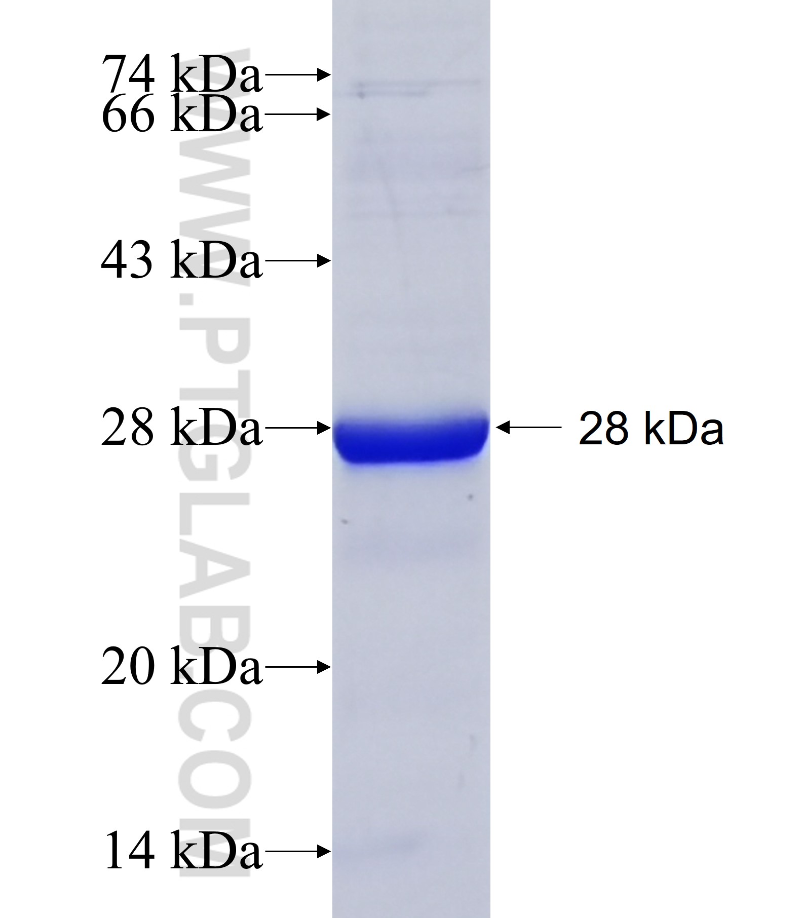 ZNF425 fusion protein Ag40851 SDS-PAGE ZNF425 fusion protein Ag40851 SDS-PAGE