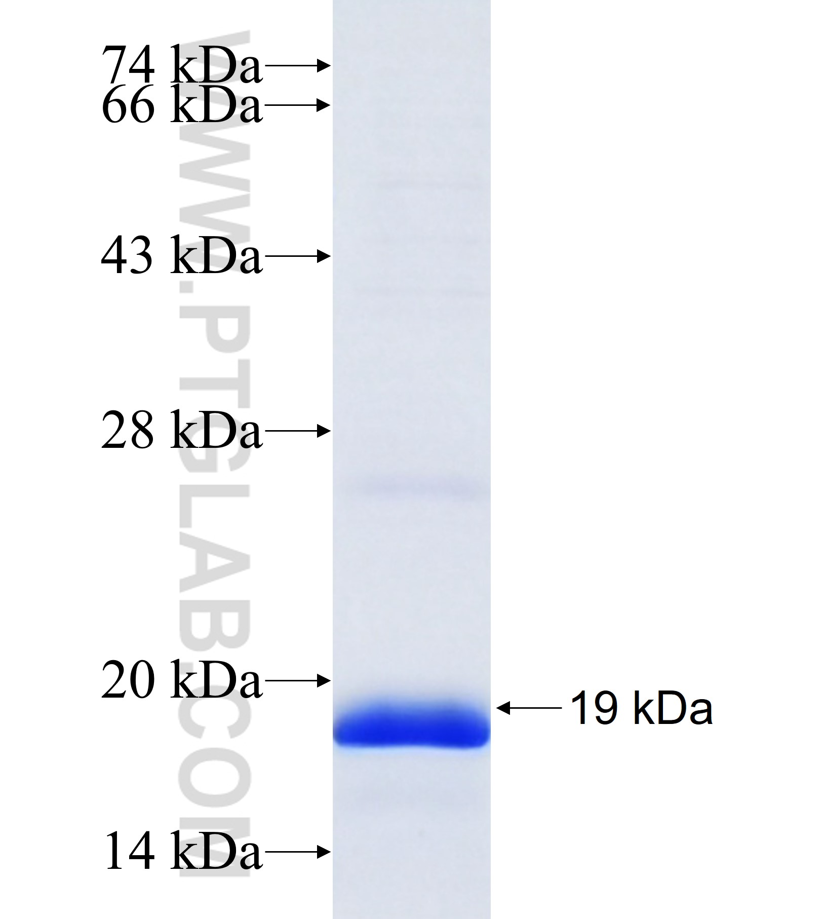 ZNF433 fusion protein Ag38075 SDS-PAGE ZNF433 fusion protein Ag38075 SDS-PAGE