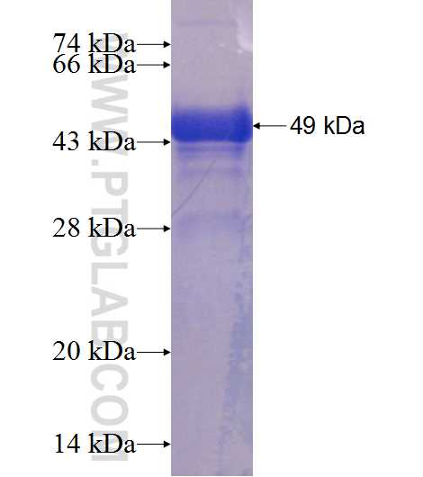 ZNF436 fusion protein Ag23593 SDS-PAGE ZNF436 fusion protein Ag23593 SDS-PAGE